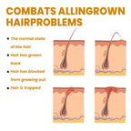 Bikini Area Hair Serum for Irritation Relief and Smooth Skin